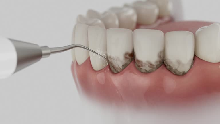Trusted Dental Implants service in Richwood, WV - Dentist Open Now